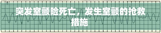 突发室颤险死亡,发生室颤的抢救措施